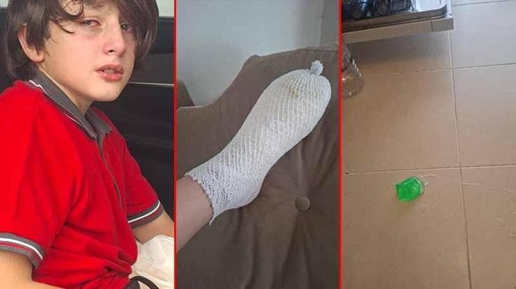 11 yaşındaki Furkan'ın elinde patlayın oyuncak için suç duyurusu