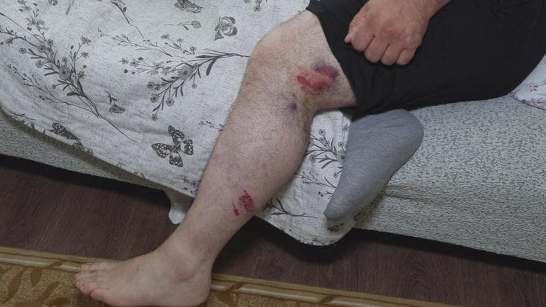Başakşehir'de kızıyla ekmek almaya giderken motosiklet çarptı: Ölebilirdim